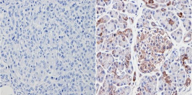 VDAC Antibody in Immunohistochemistry (Paraffin) (IHC (P))