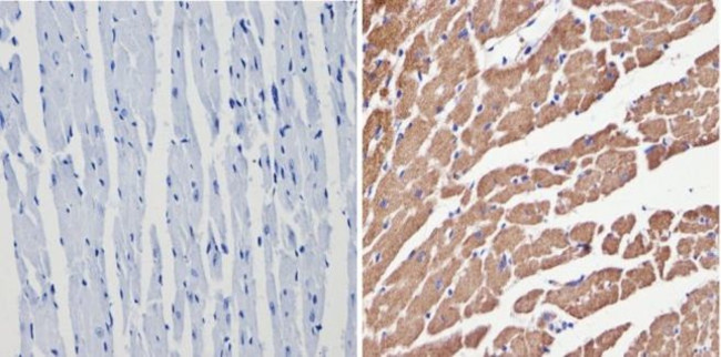 VDAC Antibody in Immunohistochemistry (Paraffin) (IHC (P))