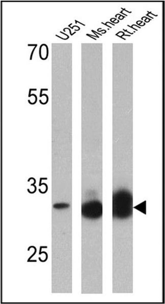 VDAC Antibody in Western Blot (WB)