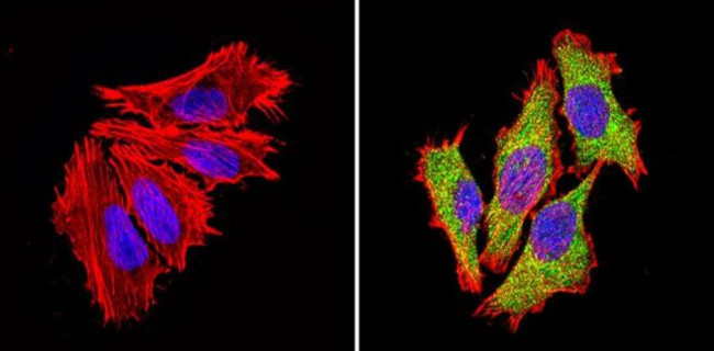 PSMD3 Antibody in Immunocytochemistry (ICC/IF)