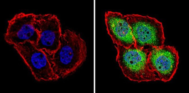 PSMB5 Antibody in Immunocytochemistry (ICC/IF)