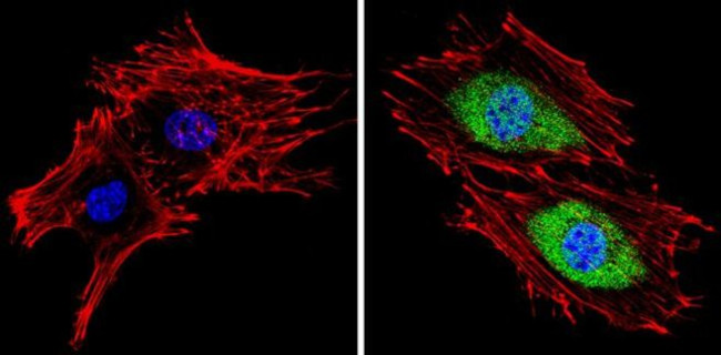 PSMB5 Antibody in Immunocytochemistry (ICC/IF)