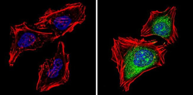 PSMB5 Antibody in Immunocytochemistry (ICC/IF)