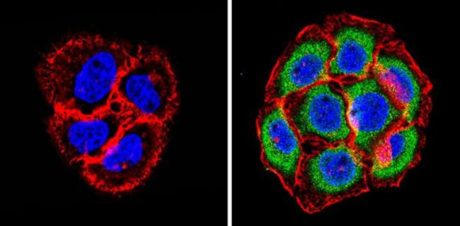 PSMB6 Antibody in Immunocytochemistry (ICC/IF)