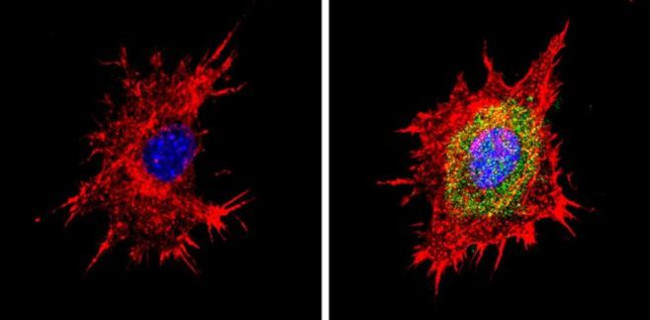 PSMB6 Antibody in Immunocytochemistry (ICC/IF)