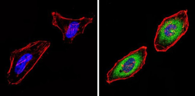 PSMB6 Antibody in Immunocytochemistry (ICC/IF)