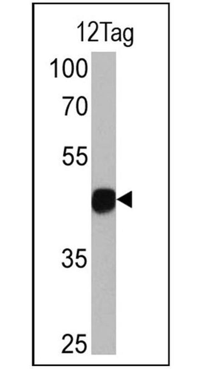 HA Tag Antibody in Western Blot (WB)