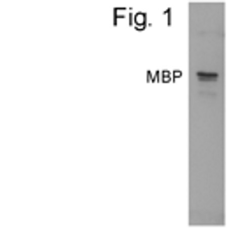 Maltose Binding Protein Antibody in Western Blot (WB)