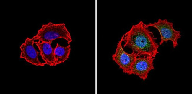 PKR Antibody in Immunocytochemistry (ICC/IF)