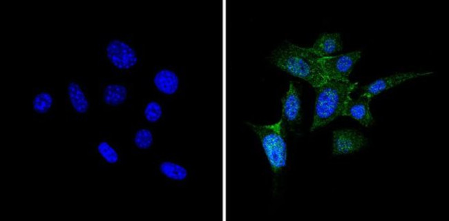 PKR Antibody in Immunocytochemistry (ICC/IF)