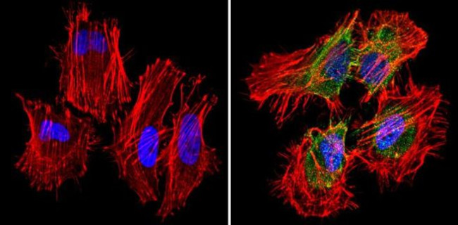 PKR Antibody in Immunocytochemistry (ICC/IF)