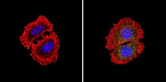 PKR Antibody in Immunocytochemistry (ICC/IF)