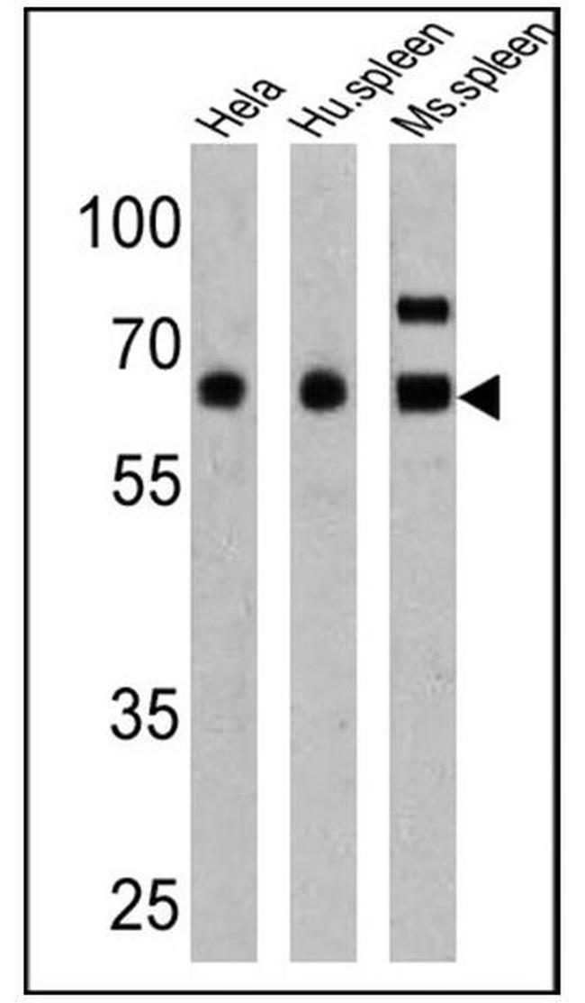 PKR Antibody in Western Blot (WB)