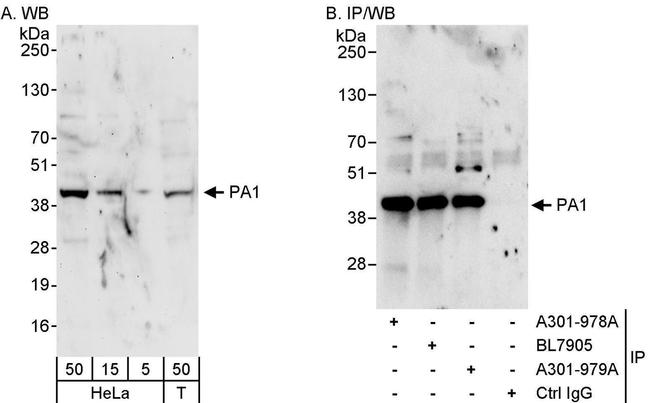 PA1 Antibody in Western Blot (WB)