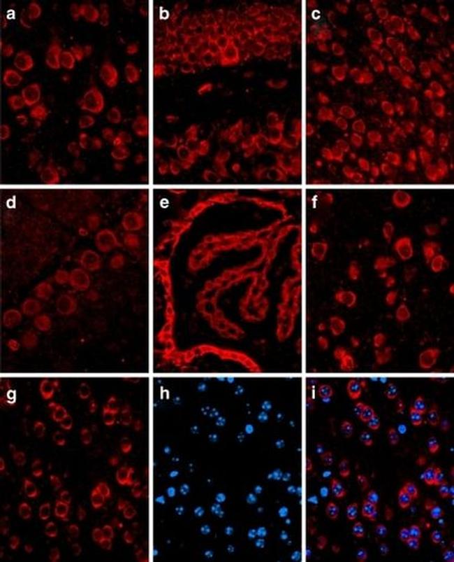 STUB1 Antibody in Immunohistochemistry (IHC)