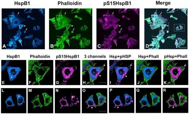 Phospho-HSP27 (Ser15) Antibody in Immunocytochemistry (ICC/IF)