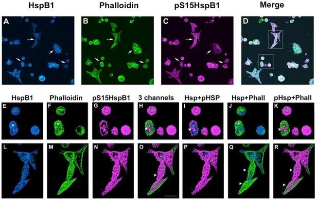 Phospho-HSP27 (Ser15) Antibody in Immunocytochemistry (ICC/IF)