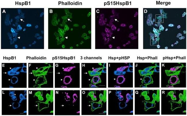 Phospho-HSP27 (Ser15) Antibody in Immunocytochemistry (ICC/IF)