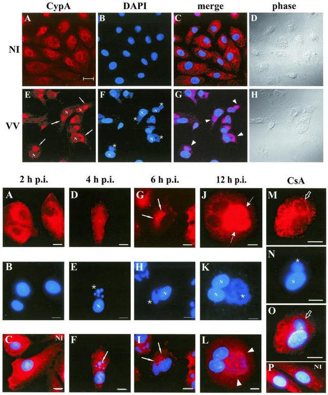 Cyclophilin A Antibody in Immunocytochemistry (ICC/IF)