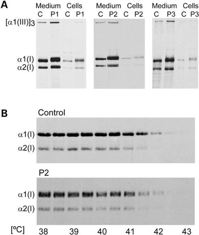 Cyclophilin B Antibody in Western Blot (WB)