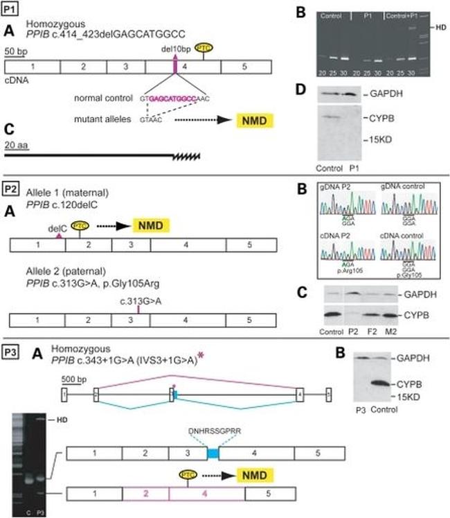 Cyclophilin B Antibody in Western Blot (WB)