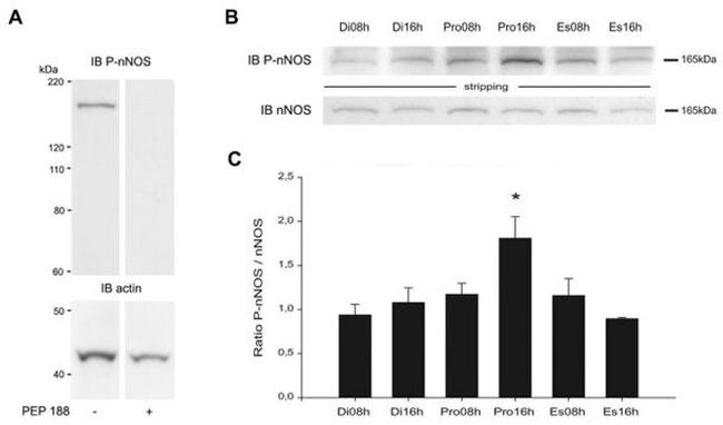 Phospho-nNOS (Ser1417) Antibody in Western Blot (WB)