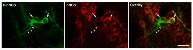 Phospho-nNOS (Ser1417) Antibody in Immunocytochemistry (ICC/IF)