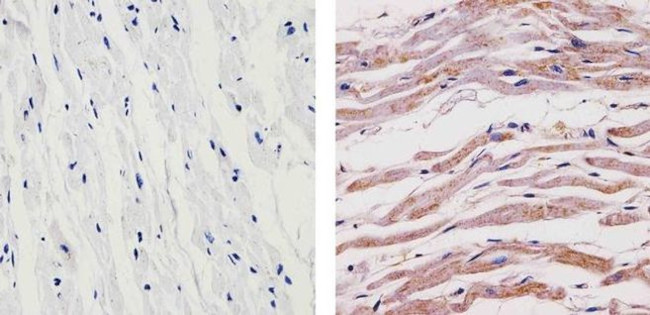 SynGAP Antibody in Immunohistochemistry (Paraffin) (IHC (P))