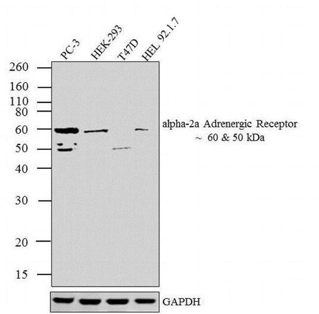 alpha-2a Adrenergic Receptor Antibody in Western Blot (WB)