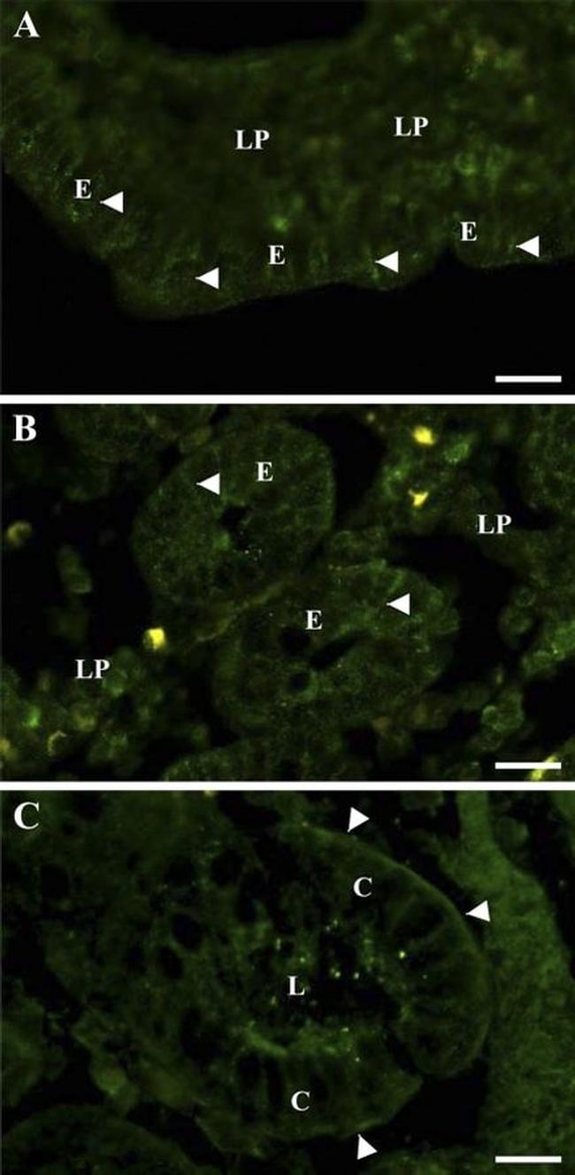 Leptin Antibody in Immunohistochemistry (IHC)