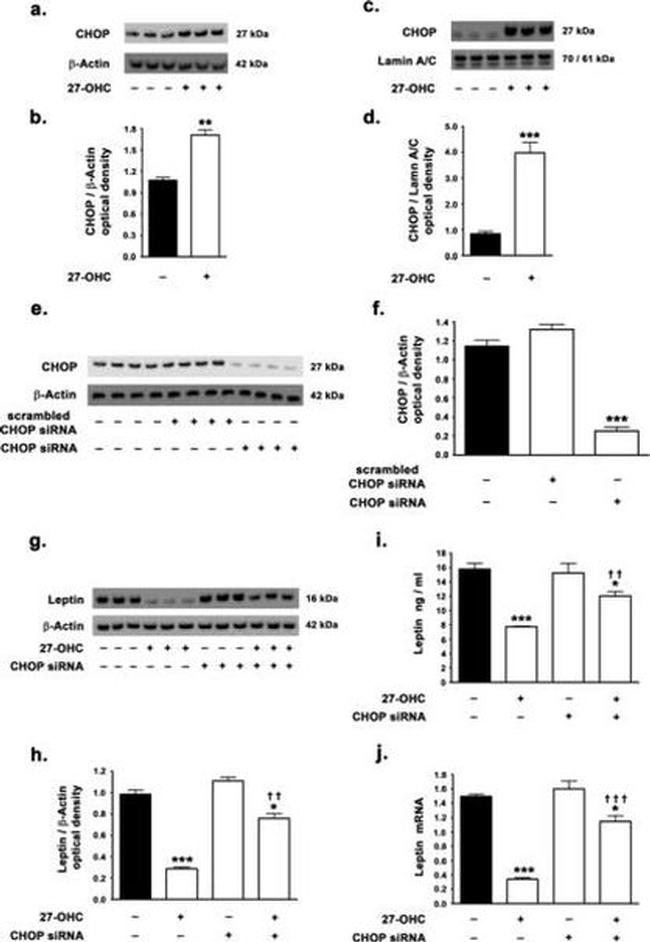 Leptin Antibody in Western Blot (WB)