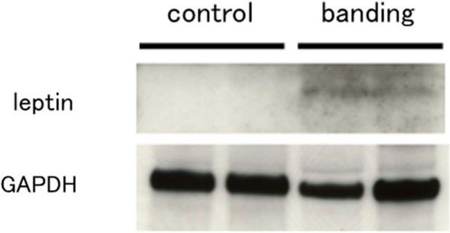 Leptin Antibody in Western Blot (WB)