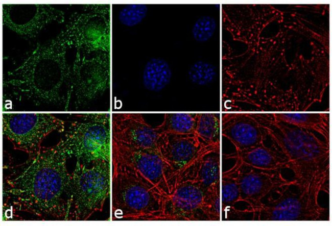 Leptin Antibody in Immunocytochemistry (ICC/IF)