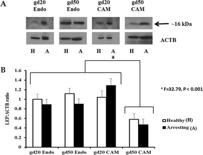 Leptin Antibody in Western Blot (WB)