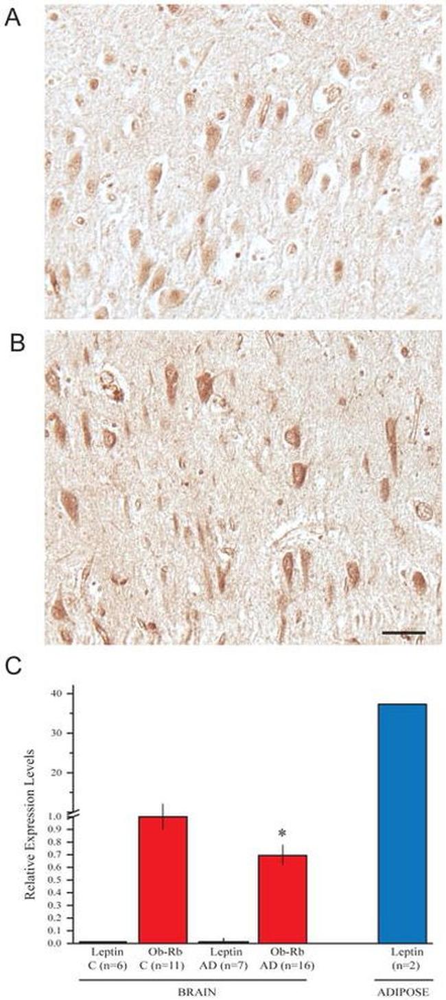 Leptin Receptor Antibody in Immunohistochemistry (IHC)