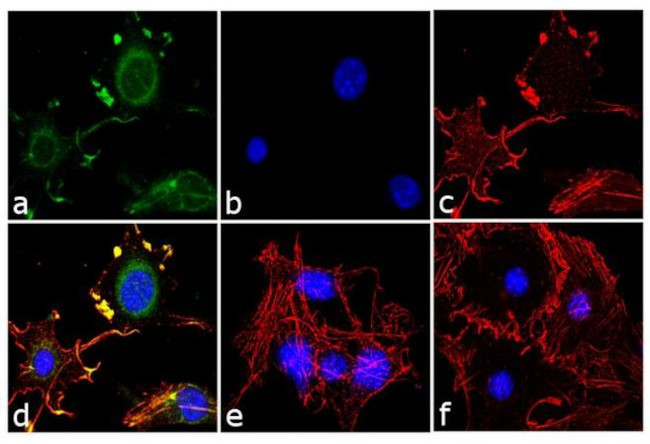 Adiponectin Antibody in Immunocytochemistry (ICC/IF)