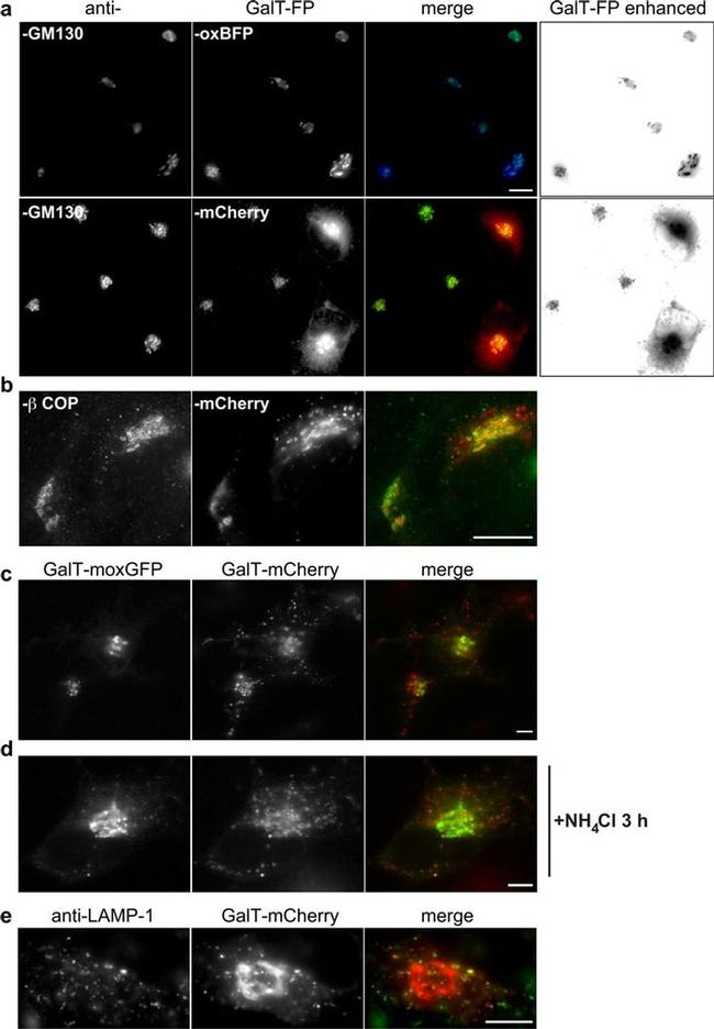 beta COP Antibody in Immunocytochemistry (ICC/IF)