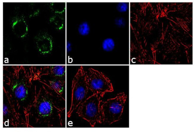 beta COP Antibody in Immunocytochemistry (ICC/IF)