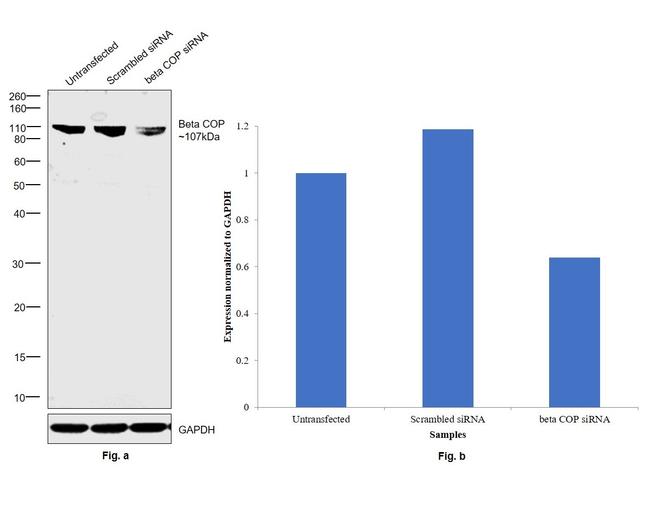 beta COP Antibody in Western Blot (WB)