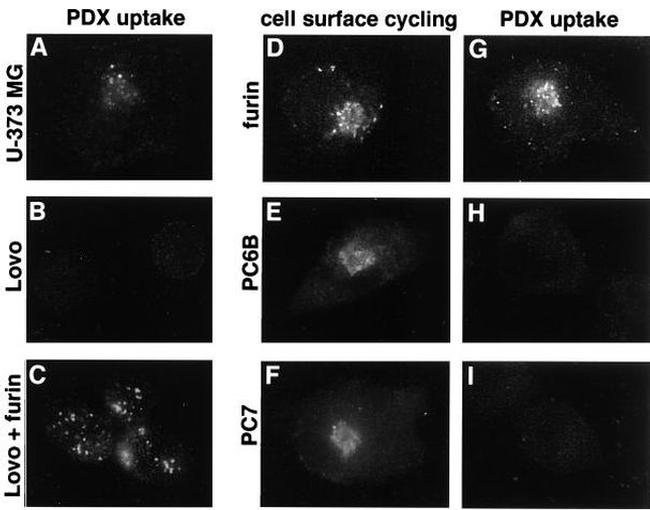 Furin Antibody in Immunocytochemistry (ICC/IF)