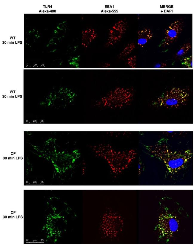 EEA1 Antibody in Immunocytochemistry (ICC/IF)