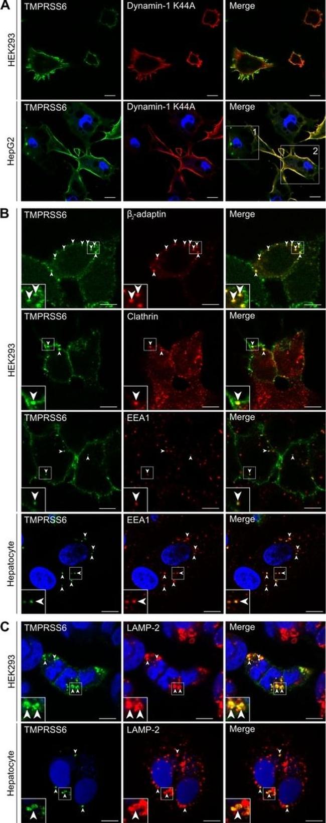 EEA1 Antibody in Immunocytochemistry (ICC/IF)