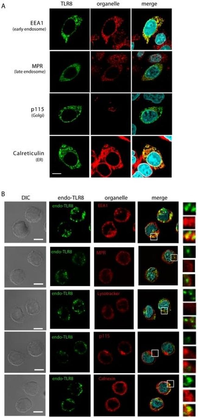 EEA1 Antibody in Immunocytochemistry (ICC/IF)