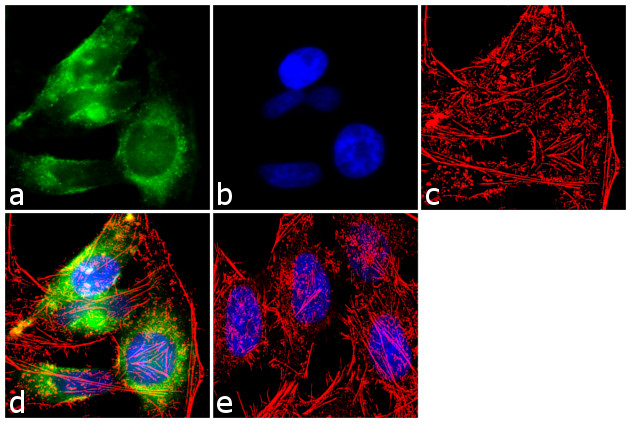 EEA1 Antibody in Immunocytochemistry (ICC/IF)