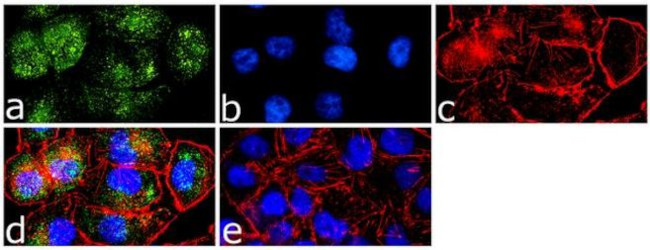 Caveolin 1 Antibody in Immunocytochemistry (ICC/IF)