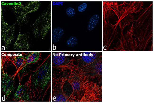 Caveolin 2 Antibody in Immunocytochemistry (ICC/IF)