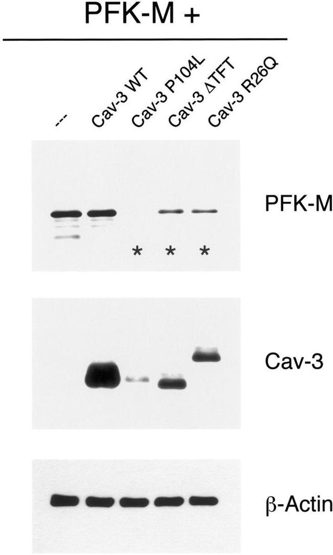 Caveolin 3 Antibody in Western Blot (WB)