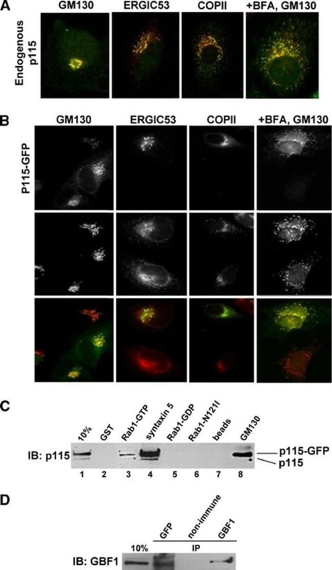 COPII Antibody in Immunocytochemistry (ICC/IF)