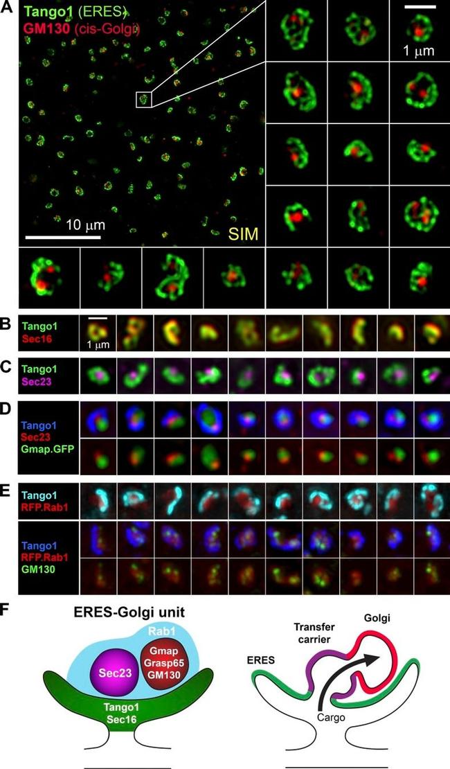 COPII Antibody in Immunocytochemistry (ICC/IF)