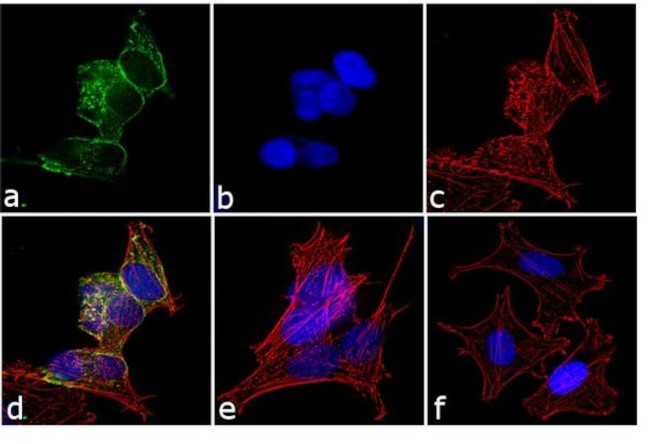 Phospho-Huntingtin (Ser421) Antibody in Immunocytochemistry (ICC/IF)